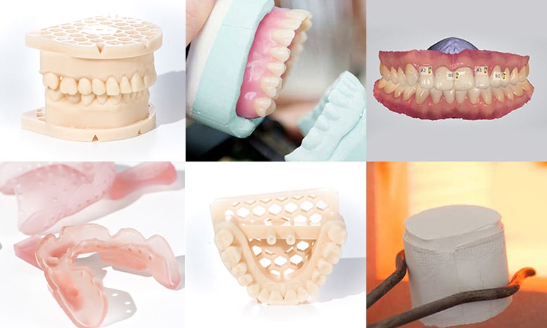 Zahnersatz aus Sachsen Sachsendental